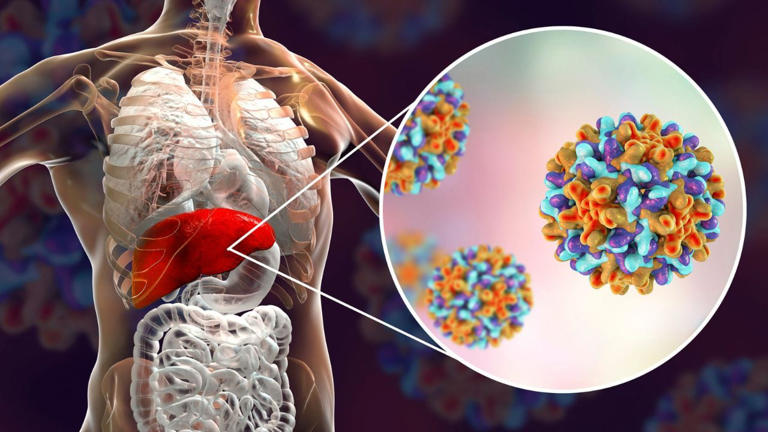 Is frequent liver infection the beginning of cancer? Lady Harding's doctor revealed the secret behind this