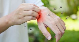 Mosquitoes Bite Causes