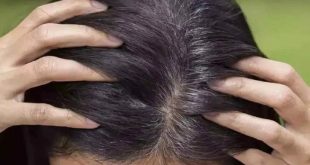 white hair remedy, white hair natural remedy, natural remedy to turn white hair into black, bottle gourd to turn white hair into black, bottle gourd benefits to white hair, white hair natural remedy,