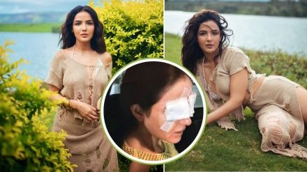 Jasmin Bhasin Facing Eyes Issues