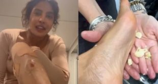 Priyanka Chopra Rubbed Garlic Cl