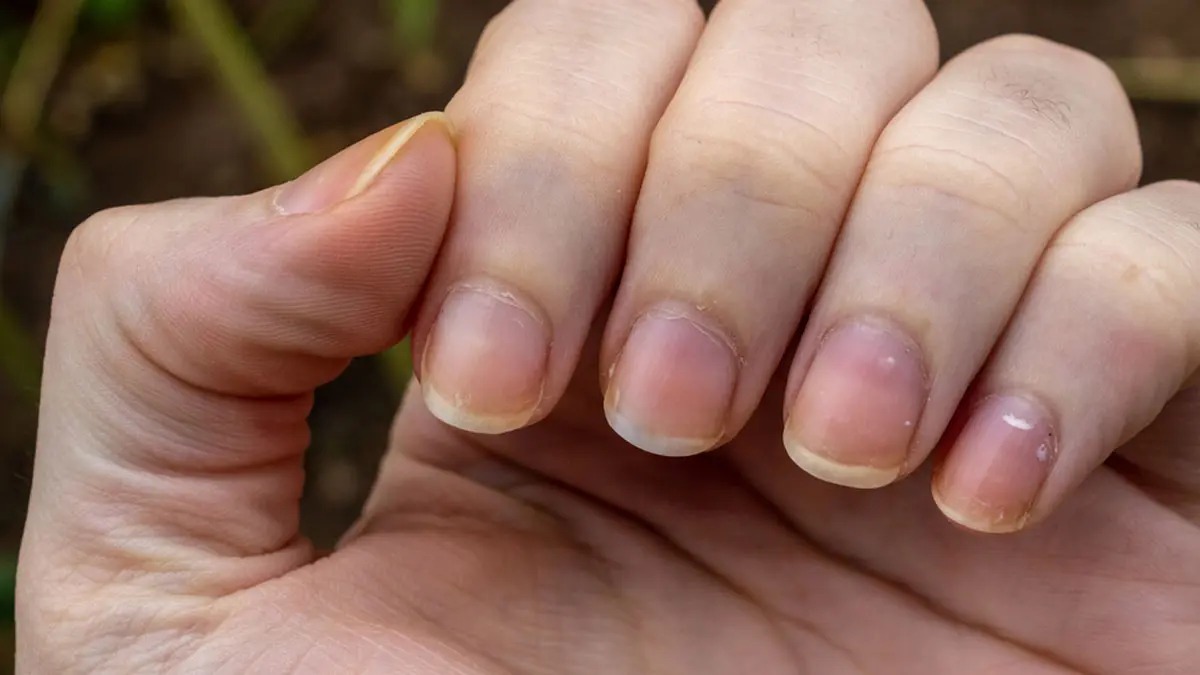 Tips To Get Rid Of Yellow Nails