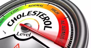 580164 Bed Cholesterol