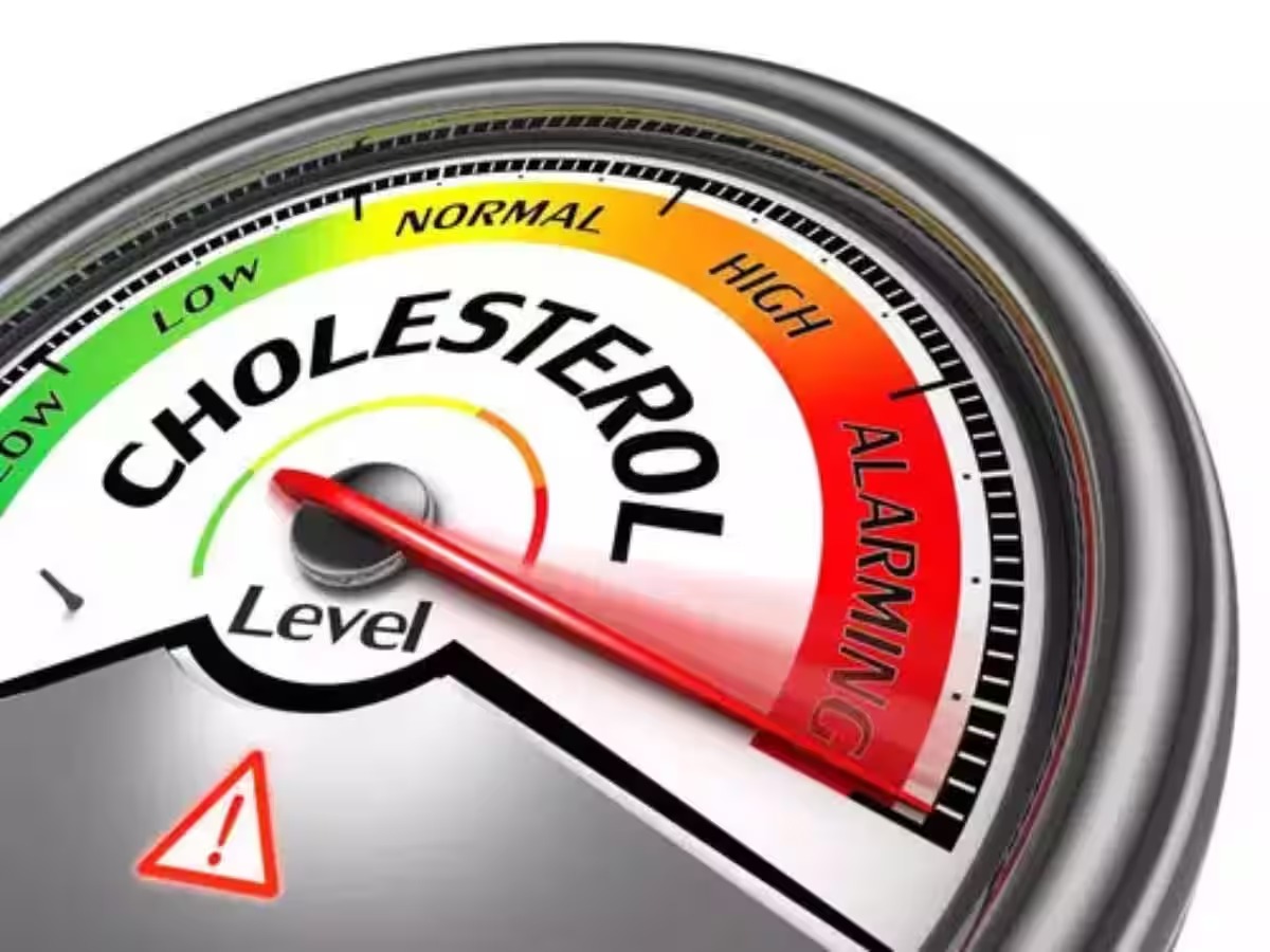 580164 Bed Cholesterol