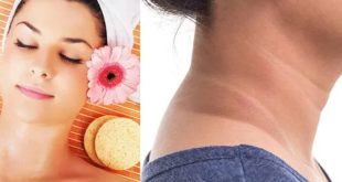 Dark Spots Near Neck 1726975736