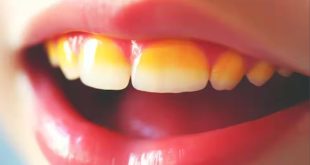 461072 Whiteningteethtips