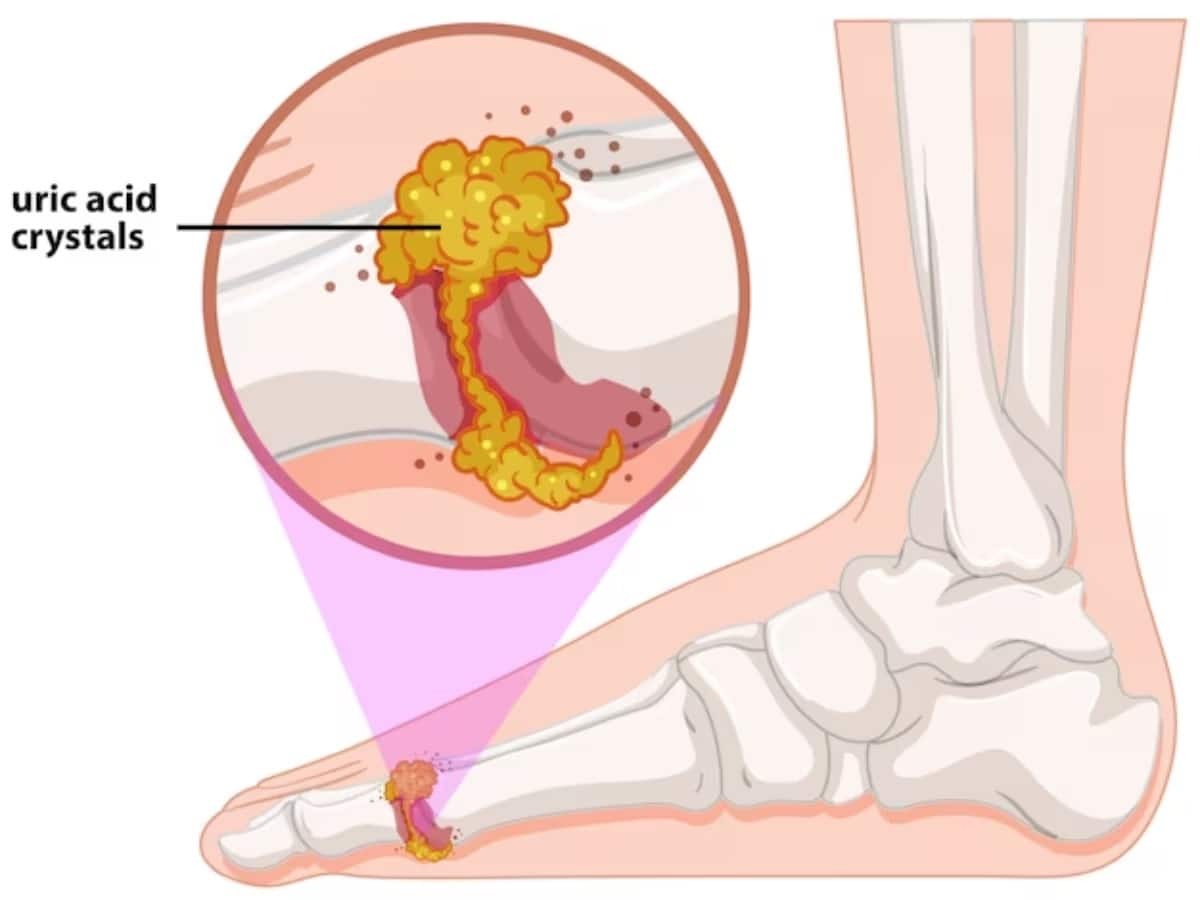 607353 Uric Acid