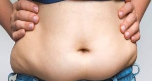 607972 Belly Fat