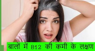 White Hair Caused By Vitamin B12