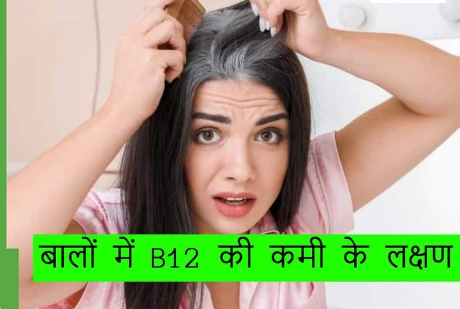 White Hair Caused By Vitamin B12