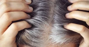 How To Get Rid Of Grey Hair 1