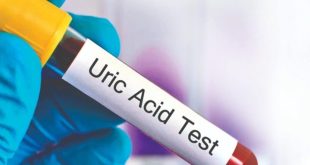 Uric Acid Test 1736495893587 17